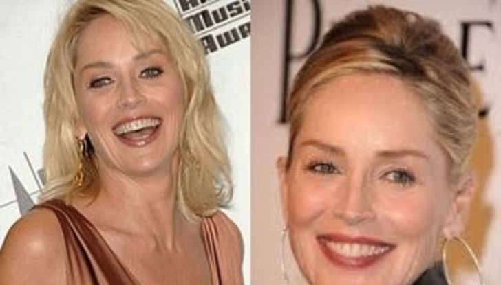 Sharon Stone Plastic Surgery: All Details